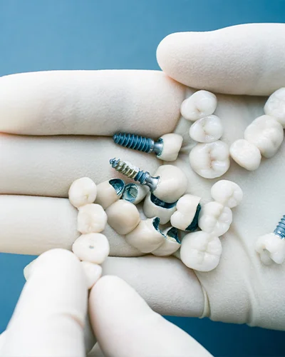 Dantu implantacija 2