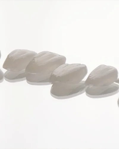 Mikroprotezavimas dantu laminatemis 2
