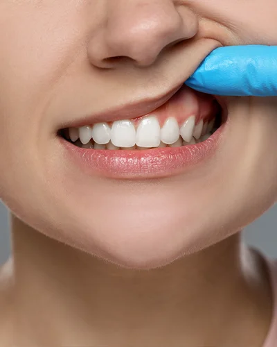 Periodontologinis gydymas 2